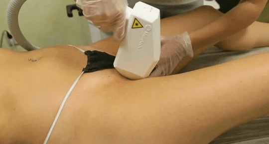 Бикини глубокое