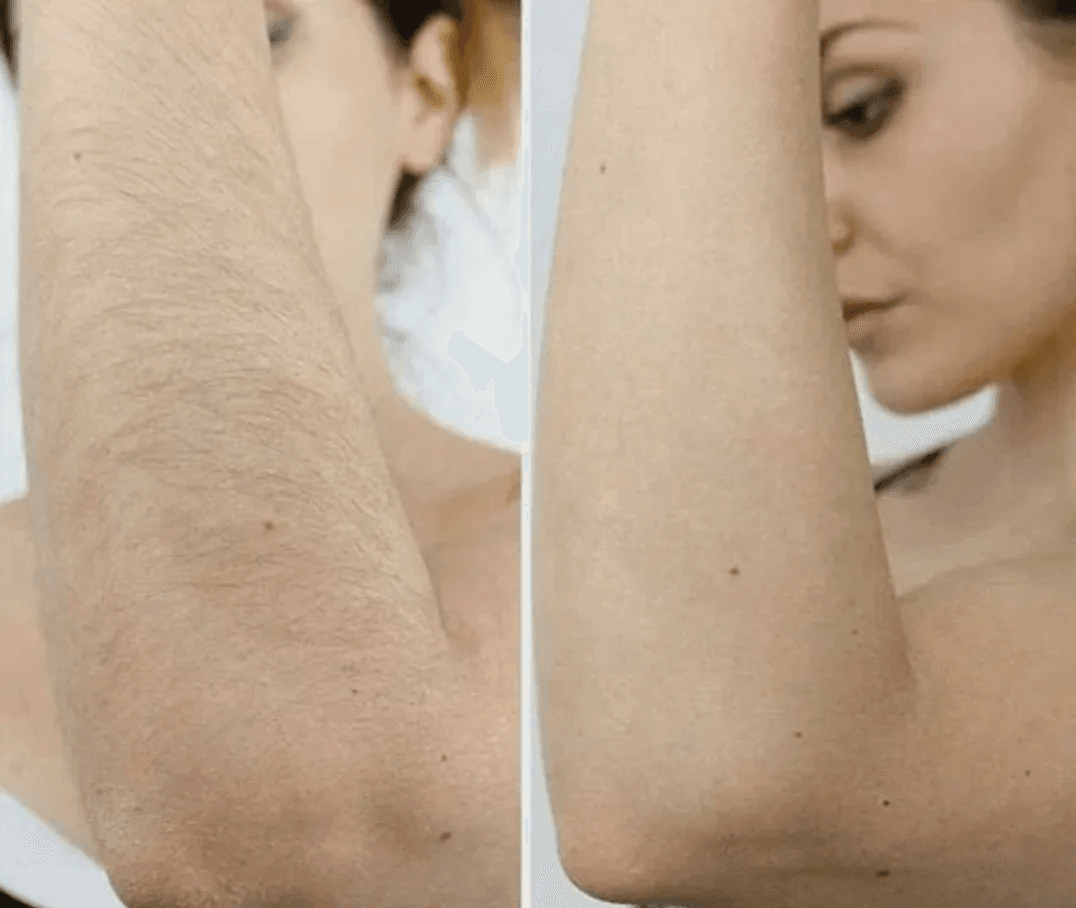 Руки до локтя