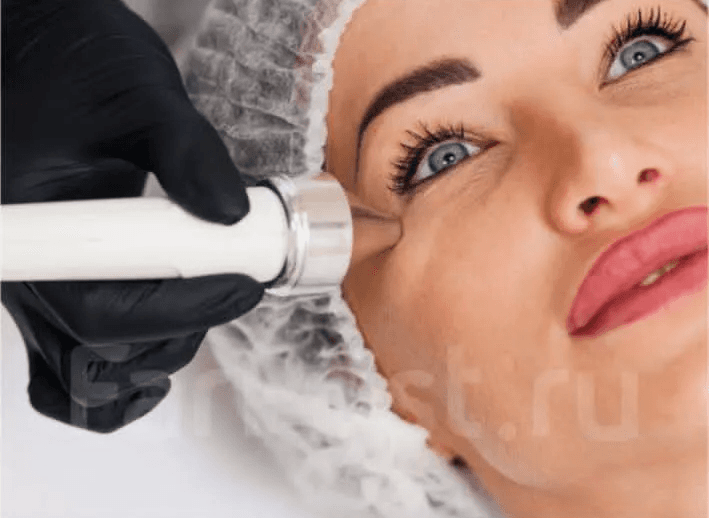 фонофорез вокруг глаз